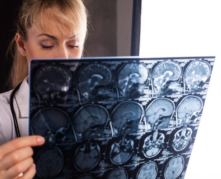 Neurological-Examination